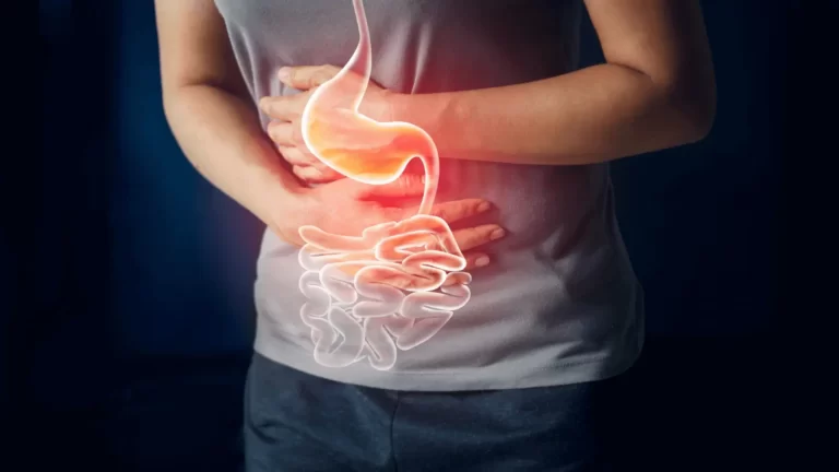 Irritable Bowel Syndrome (IBS) & Weight Loss